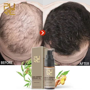 PURC חם מכירה במהירות צמיחת השיער, תמצית שמן נשירת שיער טיפול לעזור לצמיחת שיער טיפוח שיער 20ml