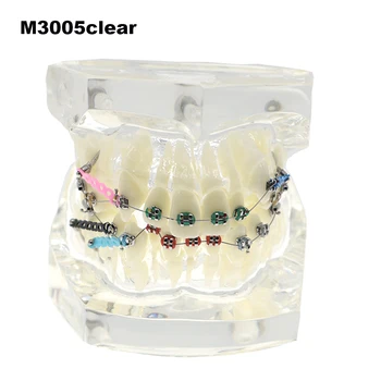 שיניים אורתודונטי סוגריים צינור אלסטי שרשרת לקשור חוט Malocclusion שיניים המודל