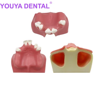 שתל דנטלי תרגול מודל הסינוסים בלסת העליונה בשיניים מודל ללימוד אימון רפואת שיניים תלמיד בחינוך כלי הדגמה